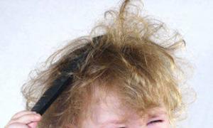 Włosy dziecka nie rosną dobrze: co robić 10-miesięcznemu dziecku nie rosną dobrze włosy