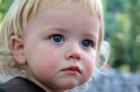 Розовые щеки у ребенка 5 лет